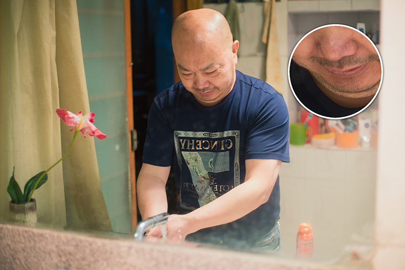 鍚夊垪鑷撮『閿嬮殣浜戞劅鑷存姢,鍚夊垪鐨勮嚧椤哄拰閿嬮殣绯诲垪