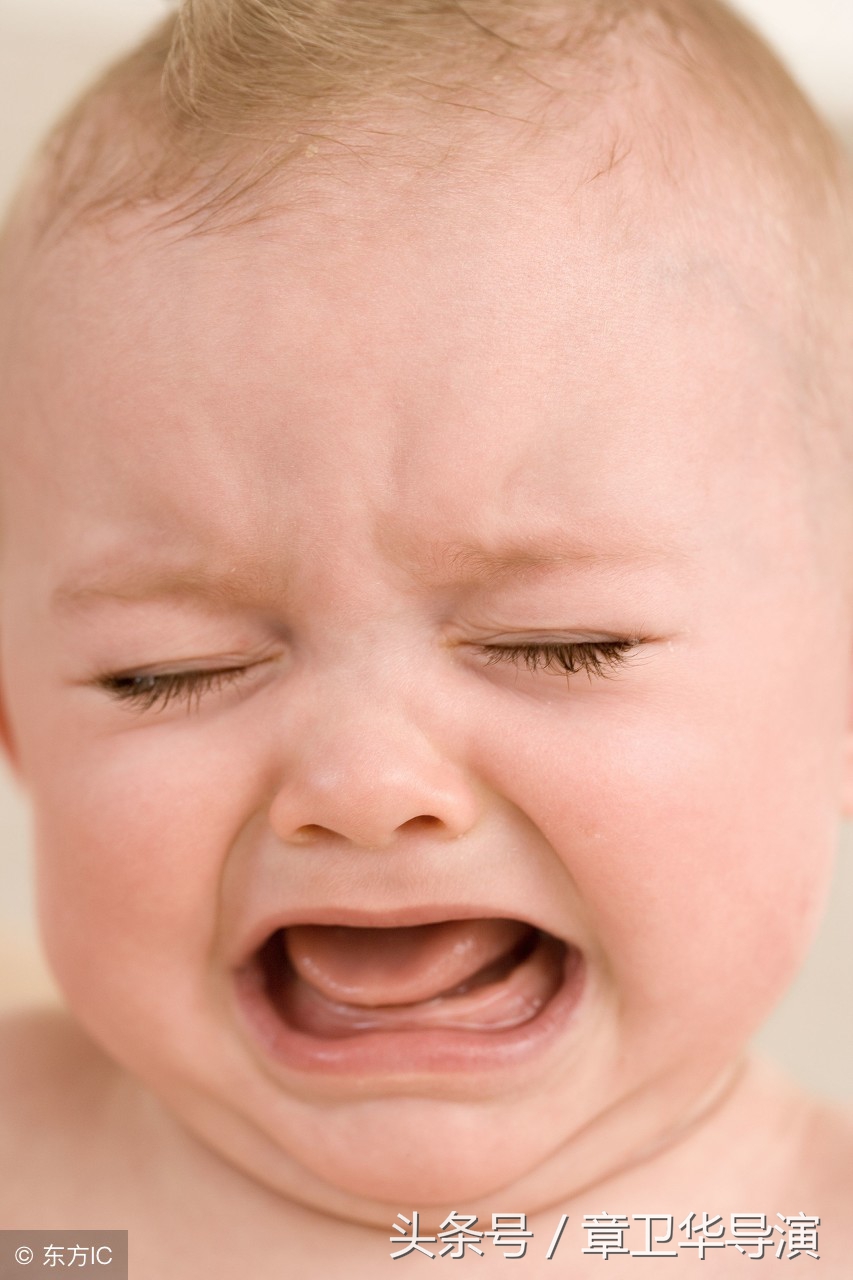 宝宝湿疹用不了激素药膏怎么治疗,宝宝湿疹不能捂