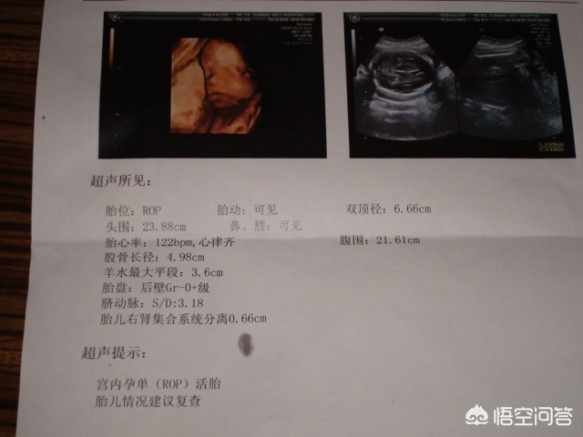 手把手教你轻松看懂产检b超单,孕初期b超看胎儿发育看哪些