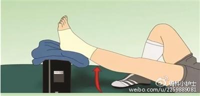 凯凯王--赵医生指导你如何处理急性踝关节扭伤！