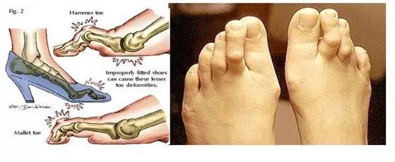 生活分享健康,生活分享给别人也就没了意义