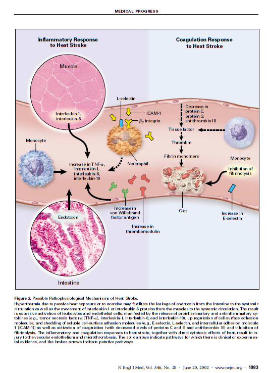 横纹肌溶解动画解说,龙虾横纹肌溶解症