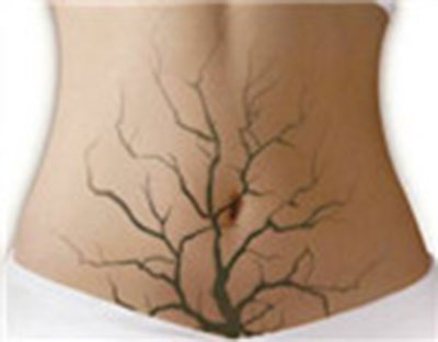 妇科炎症患者先不要怀孕，女人要保护好自己！做女人的苦..