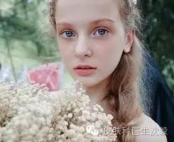 以为是灰指甲结果指甲掉了,得了灰指甲不管它行吗