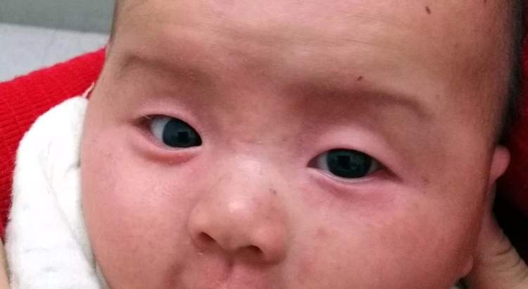 小孩眼红流泪有眼屎用什么滴眼液,孩子眼红有眼屎眼睛痒怎么办