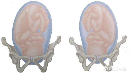 38周没入盆要做入盆操吗,怀孕多少周正常入盆