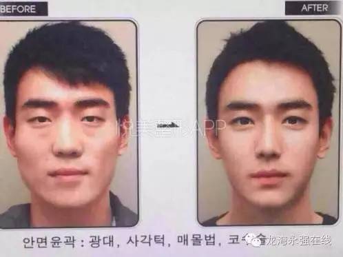 汗！温州一男子点掉了脸上的痣，结果在*证办**时“遇阻”！原因是......