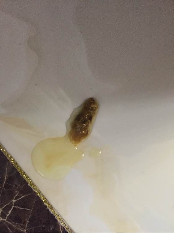 泰迪狗狗突然拉肚子呕吐,狗狗昨天拉稀今天口吐白沫