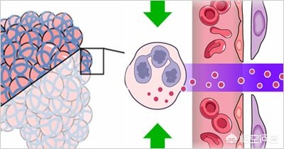 间质性肺炎纤维化咳嗽吃什么药,间质性肺炎咳嗽特别厉害用什么药