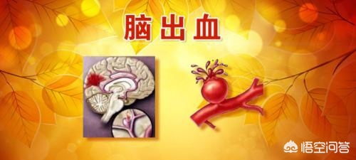老年人预防脑出血最佳方法,预防脑出血针灸的最佳穴位