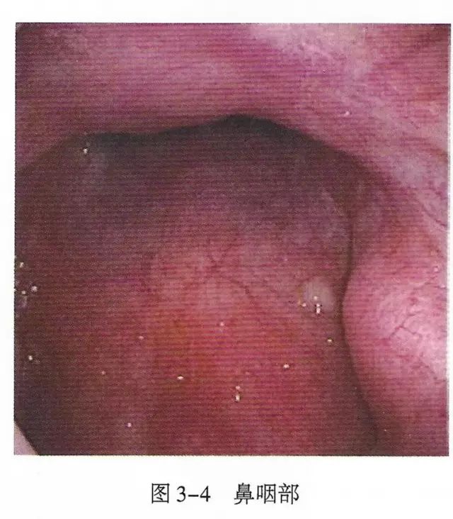 鍛煎惛閬撶殑瑙e墫缁撴瀯缁勬垚,涓嬪懠鍚搁亾瑙e墫瑙嗛鏁欑▼