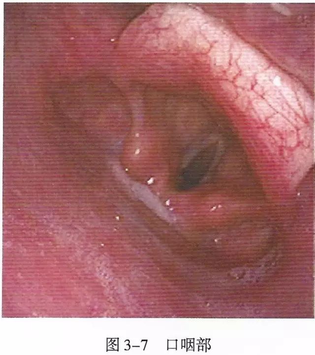下呼吸道详细图解,必备上呼吸道解剖详解