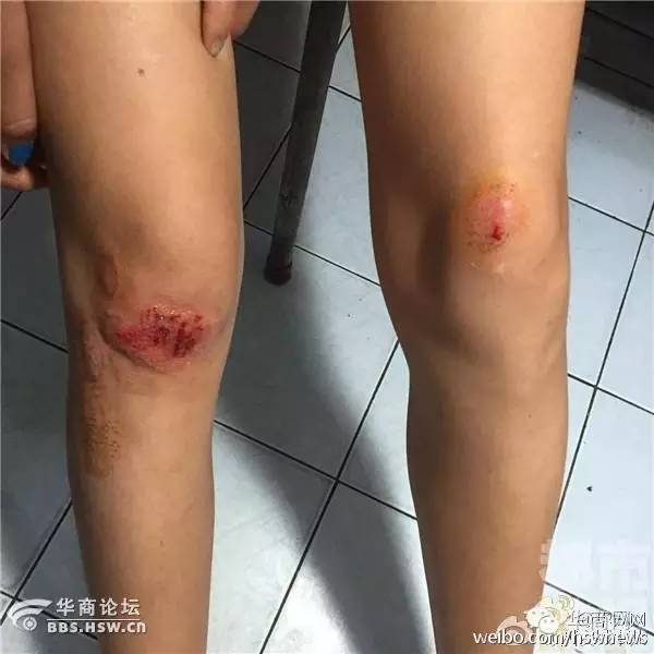 西安一女子遭飞车抢劫,陕西西安女子手机被碾后续