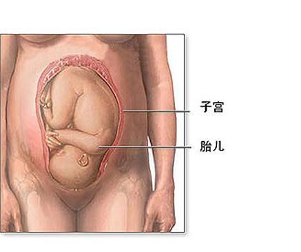 剖腹产没有想象中的那么可怕,剖腹产手术中的真实感受