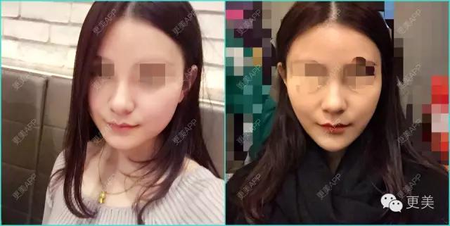 什么瘦脸霜最快最有效,瘦脸霜有用吗