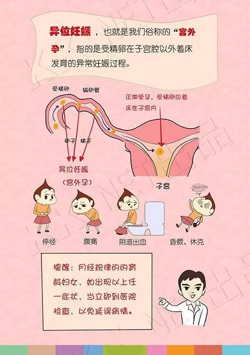 甘肃省妇幼保健院误诊宫外孕,孕育科普如何避免再次发生宫外孕