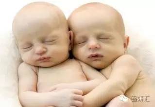 双胎妈妈后期危险,双胎妈妈产前准备物品