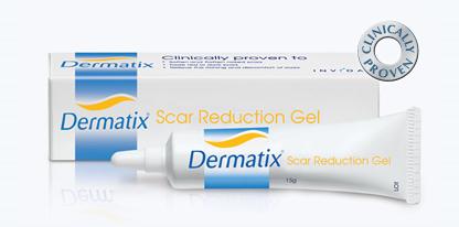 你知道如何挑选祛疤产品吗？三款知名祛疤膏对比