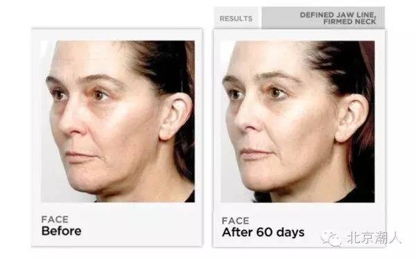 美容仪在家做,家用美容仪的正确用法