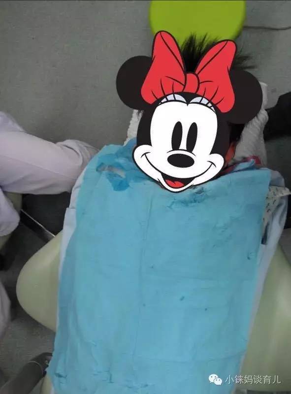 乳牙掉了没牙根怎么补牙,儿童乳牙龋齿烂了有必要补牙吗