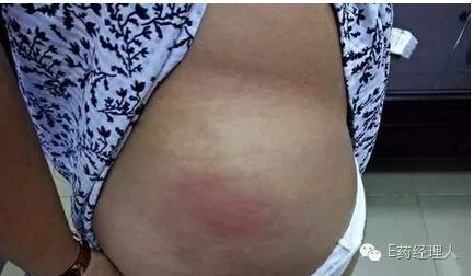 震惊孕妇小心！海南再现百例黄体酮不良事件