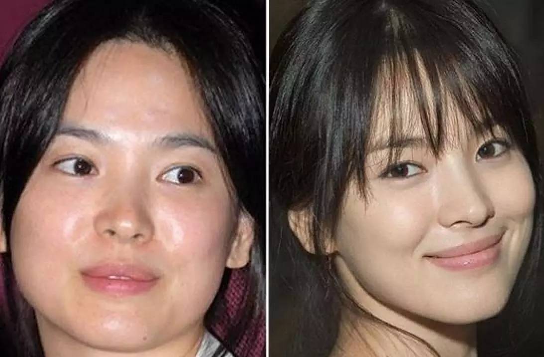 不用打针做水光,不用打水光给你水光肌的效果