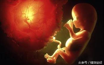 怀孕三个月医生诊断前置胎盘,怀孕时发现是前置胎盘怎么办