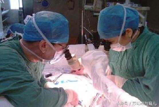 32岁结扎后怀孕三胎该要吗,结扎了意外怀孕了宝宝能要吗