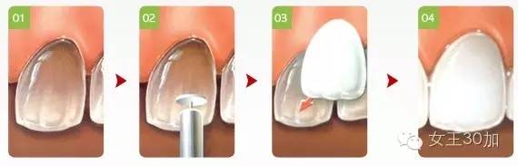 新美容|唇膏买嗨了,可你的牙配得上这些唇膏吗?