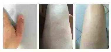 母乳冰敷！美女医生做“直播”引来一群网友围观：长知识了！