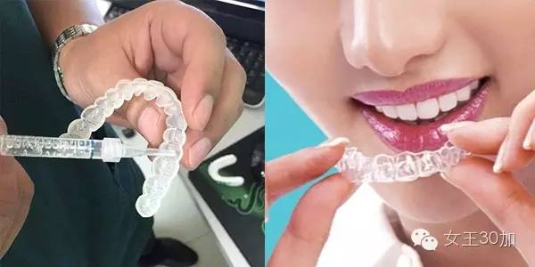 新美容|唇膏买嗨了,可你的牙配得上这些唇膏吗?