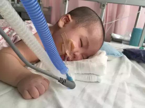 庞贝氏病全国有几例,庞贝氏症俗称什么病