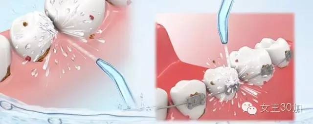 新美容|唇膏买嗨了,可你的牙配得上这些唇膏吗?