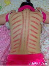 治感冒喉咙痛的偏方,治感冒喉咙疼的民间偏方小妙招