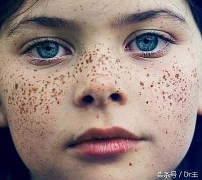 牙龈变色暗示哪里有病,牙龈变黑是什么征兆