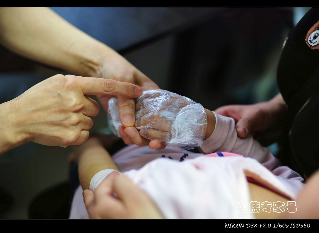 暑热季节湿疹怎么消除,冬季湿疹的误区