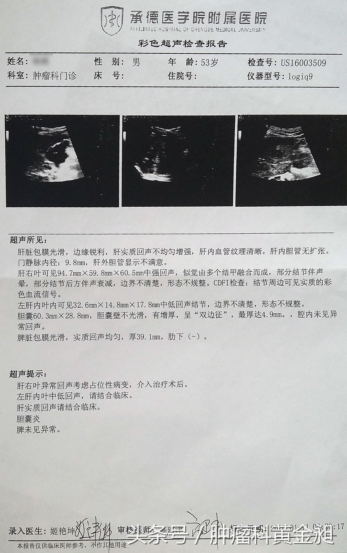中药治疗肝癌晚期的成功案例,中药治肝癌肿瘤晚期的药方