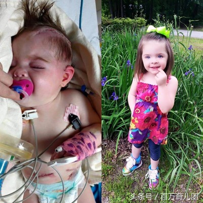 吃了糖丸疫苗宝宝不肯喝奶粉,宝宝8个月吃了糖丸疫苗