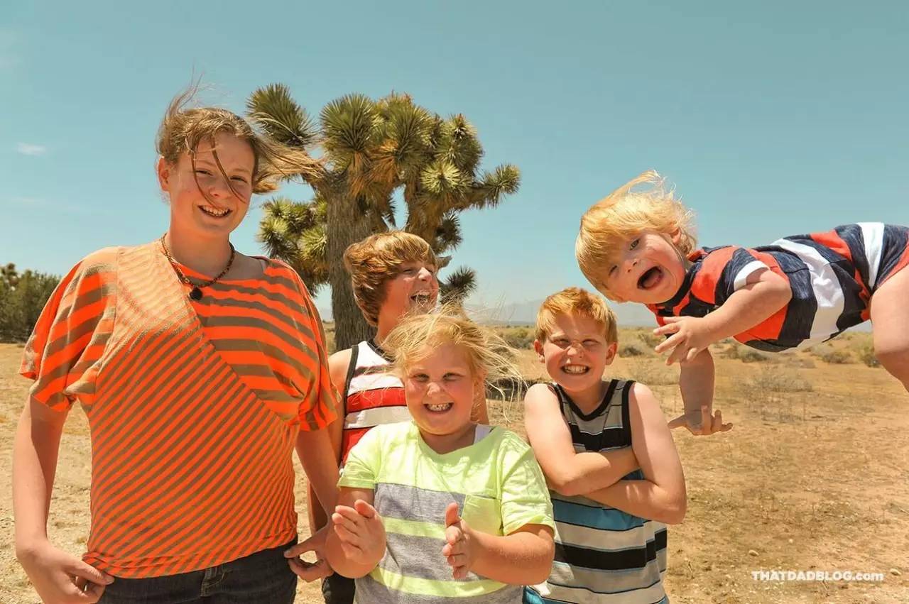 小孩患唐氏综合征,唐氏综合征比较幸运的孩子