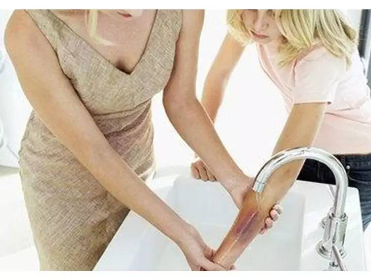 一周半宝宝被烫伤怎么办,宝宝被烫伤正确的处理方法