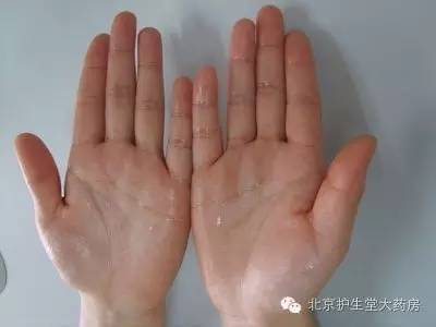 手脚冰凉出汗是什么原因引起的,手脚爱出汗是什么原因
