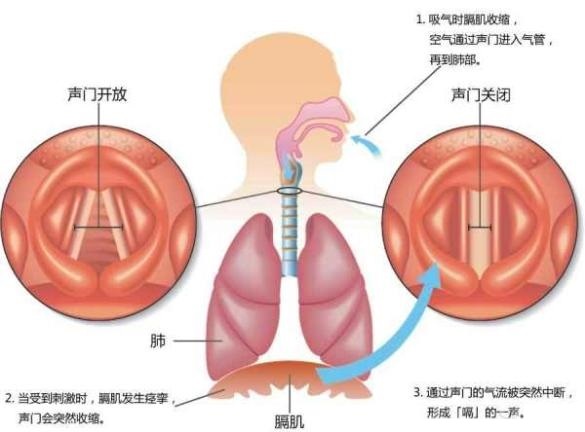 打嗝止不住一招搞定,打嗝停不下来偏方