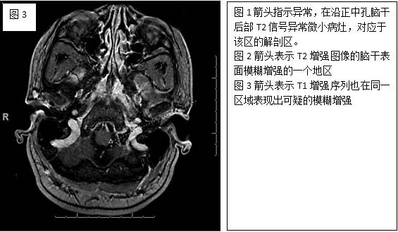 顽固性呕吐是什么意思,反射性呕吐怎么缓解