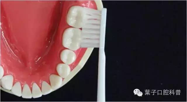 蛀牙怎么才能清洗干净牙科,自己怎么清理牙上的蛀牙