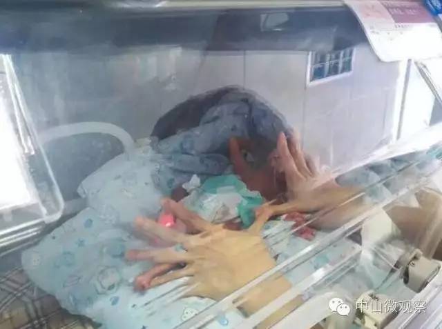 广东15岁少女产下重症男婴,2003年出生广东中山弃婴女孩