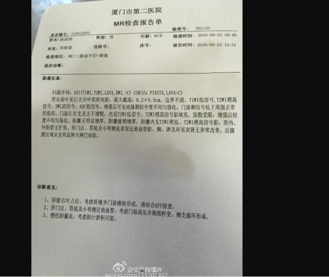 46岁肝癌晚期症状,46岁得肝癌的原因