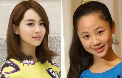 杨紫打玻尿酸,杨紫玻尿酸