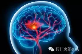 esc治疗房颤的最新方法,房颤相关急性卒中抗凝时机