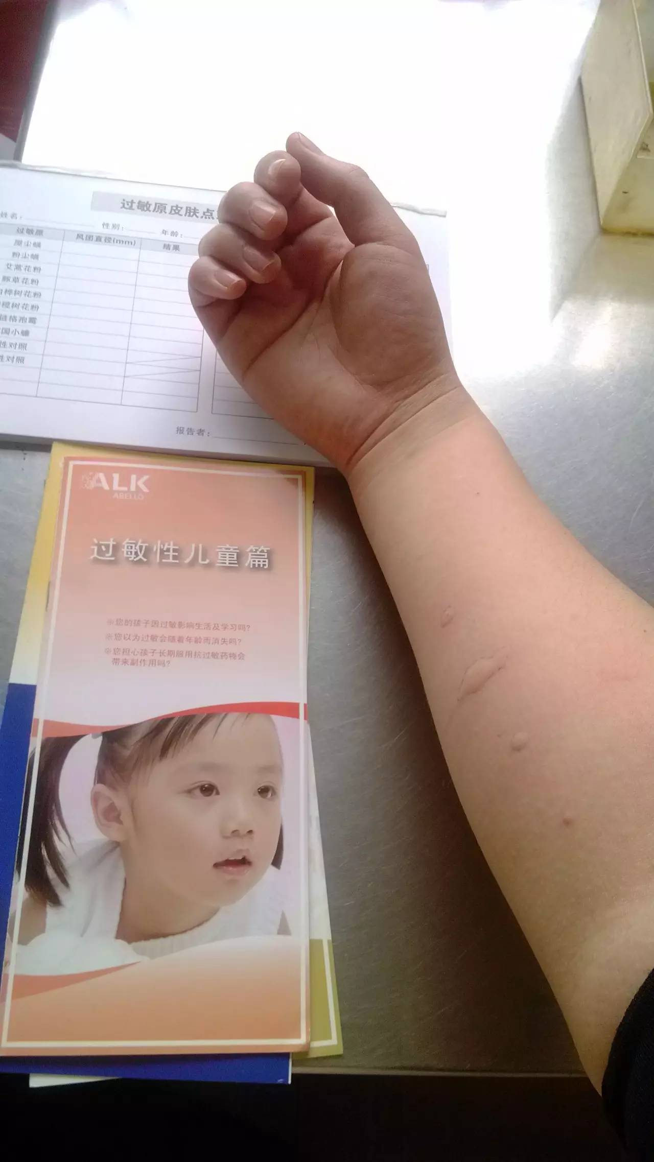 陈医生根治哮喘经验方,张景明讲小儿哮喘治疗方法