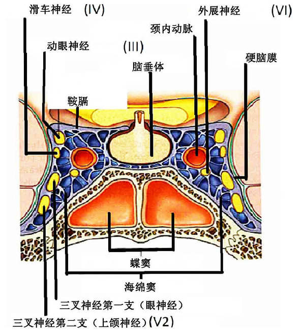 海绵窦海绵状血管瘤,海绵窦区海绵状血管瘤发病年龄